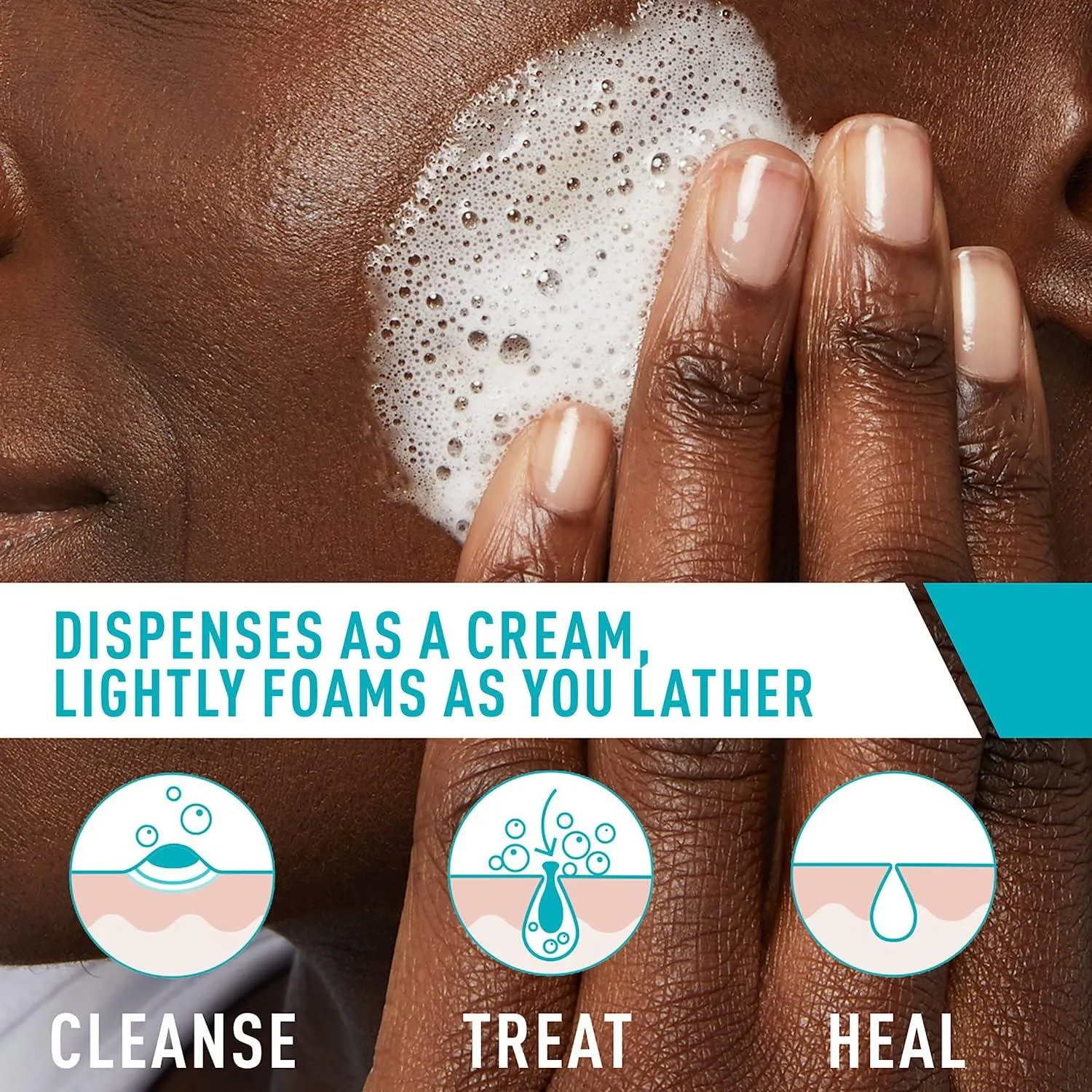 CERAVE ACNE FOAMING CREAM CLEANSER ACNE TREATMENT